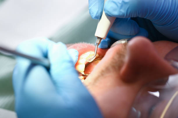 Best Emergency Denture Repair in Springfield, SD