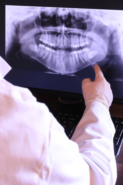 Best Walk-In Emergency Dental Services in Springfield, SD